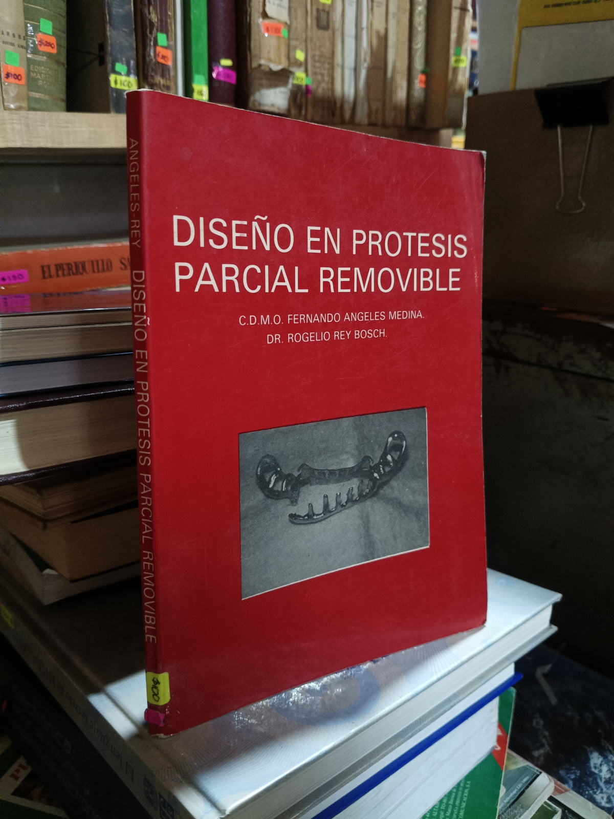 DISEÑO EN PROTESIS PARCIAL REMOVIBLE POR ANGELES Y REY USADO MEDICINA ALDAMA