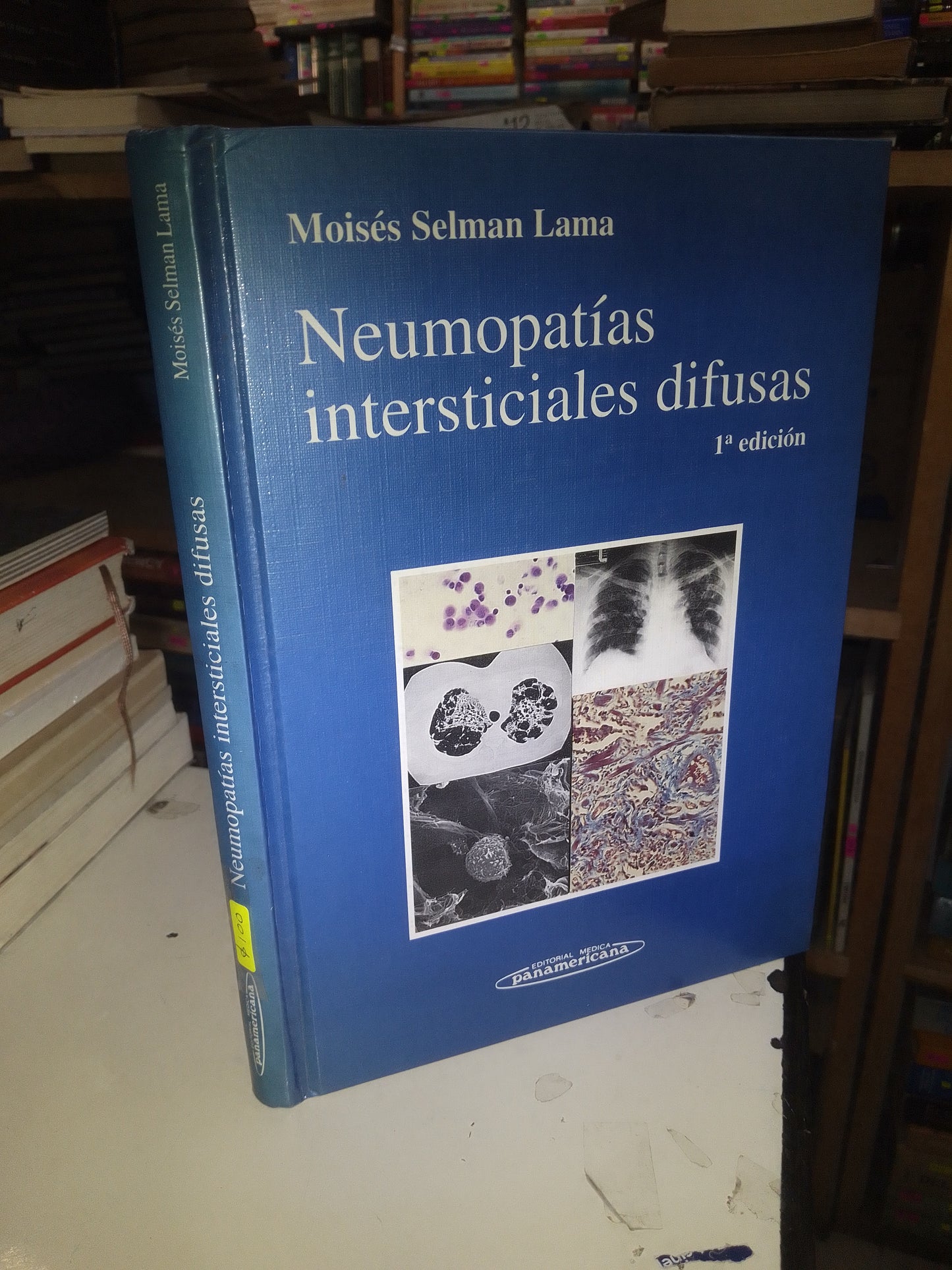 NEUMOPATIAS INTERSTICIAL ES DIFUSAS POR MOISES SELMAN LAMA USADO MEDICINA LITERARIO 207