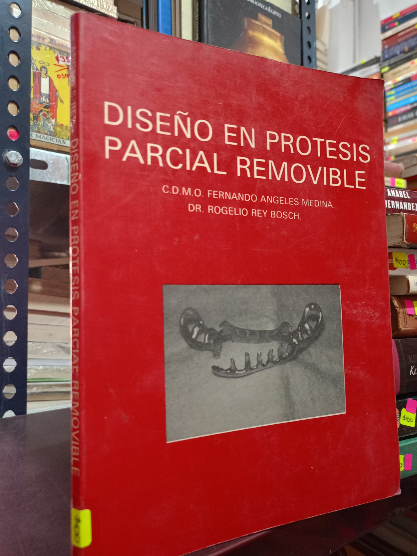 DISEÑO EN PROTESIS PARCIAL REMOVIBLE POR FERNANDO ANGELES MEDINA, ROGELIO REY BOSH USADO SALUD LITERARIO 305