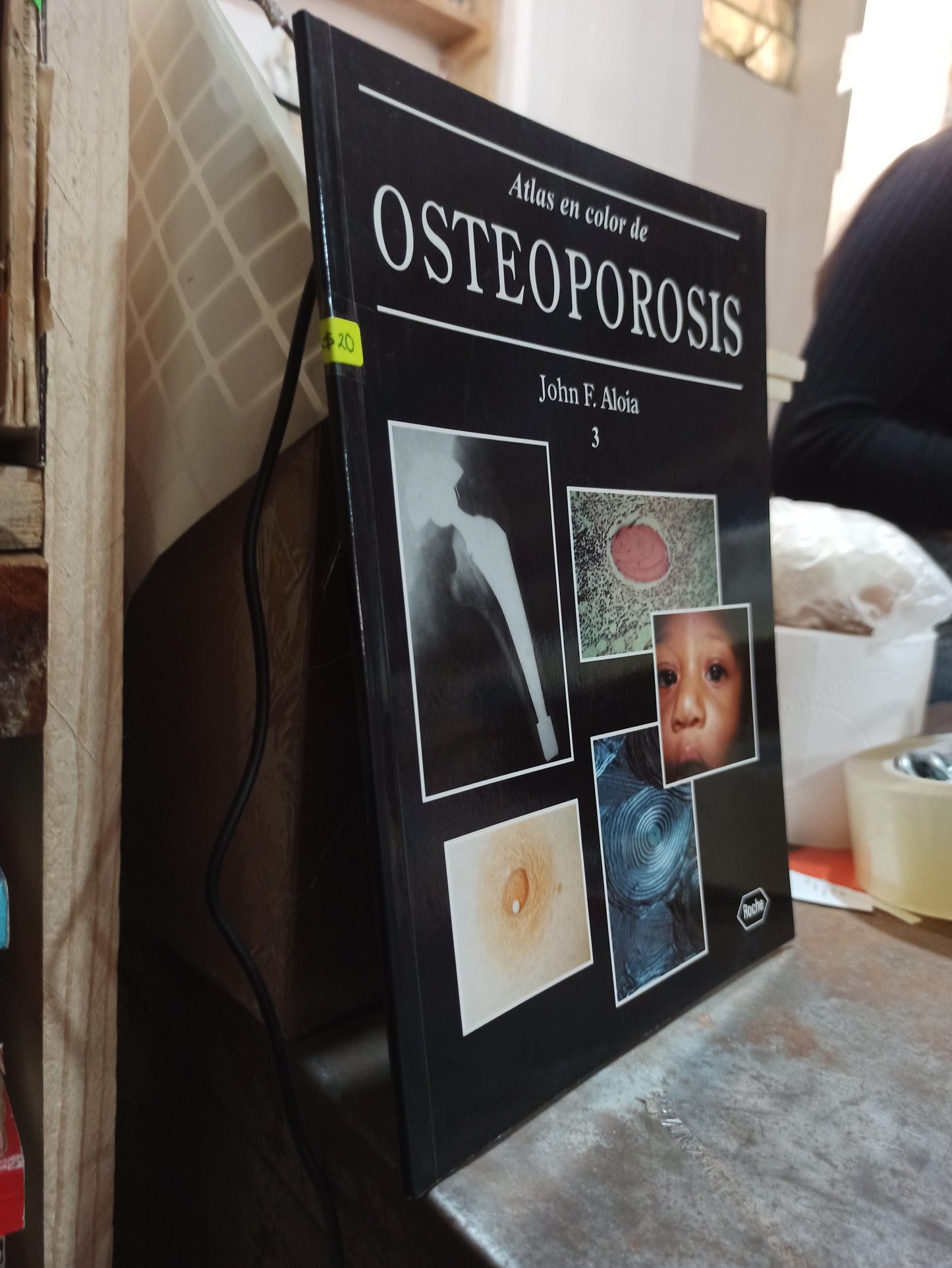 ATLAS EN COLOR DE OSTEOPOROSIS 3 POR JOHN F. ALOIA USADO SALUD ALDAMA