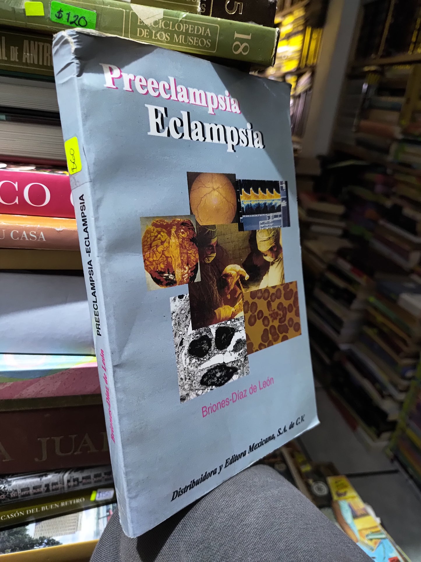 PREECLAMPSIA ECLAMPSIA POR BRIONES DIAZ DE LEON USADO SALUD JUAREZ 507