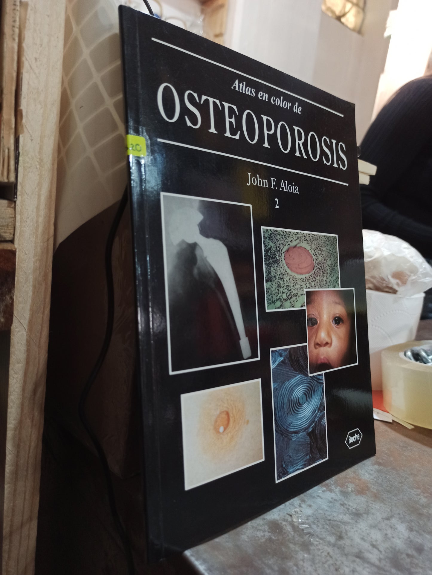 ATLAS EN COLOR DE OSTEOPOROSIS 2 POR JOHN F. ALOIA USADO SALUD ALDAMA