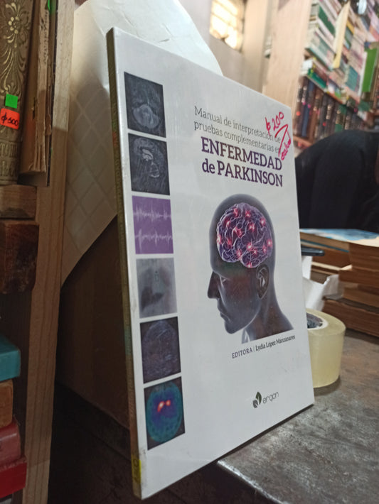ENFERMEDAD DE PARKINSON POR LYDIA LOPEZ MANZANARES USADO SALUD ALDAMA