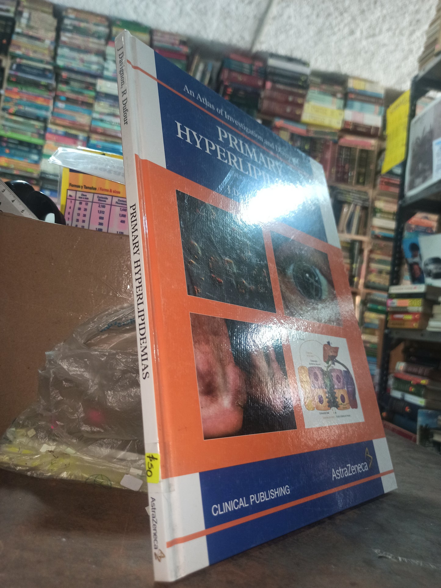 PRIMARY HYPERLIDEMIAS POR J. DAVIGNON USADO SALUD ALDAMA