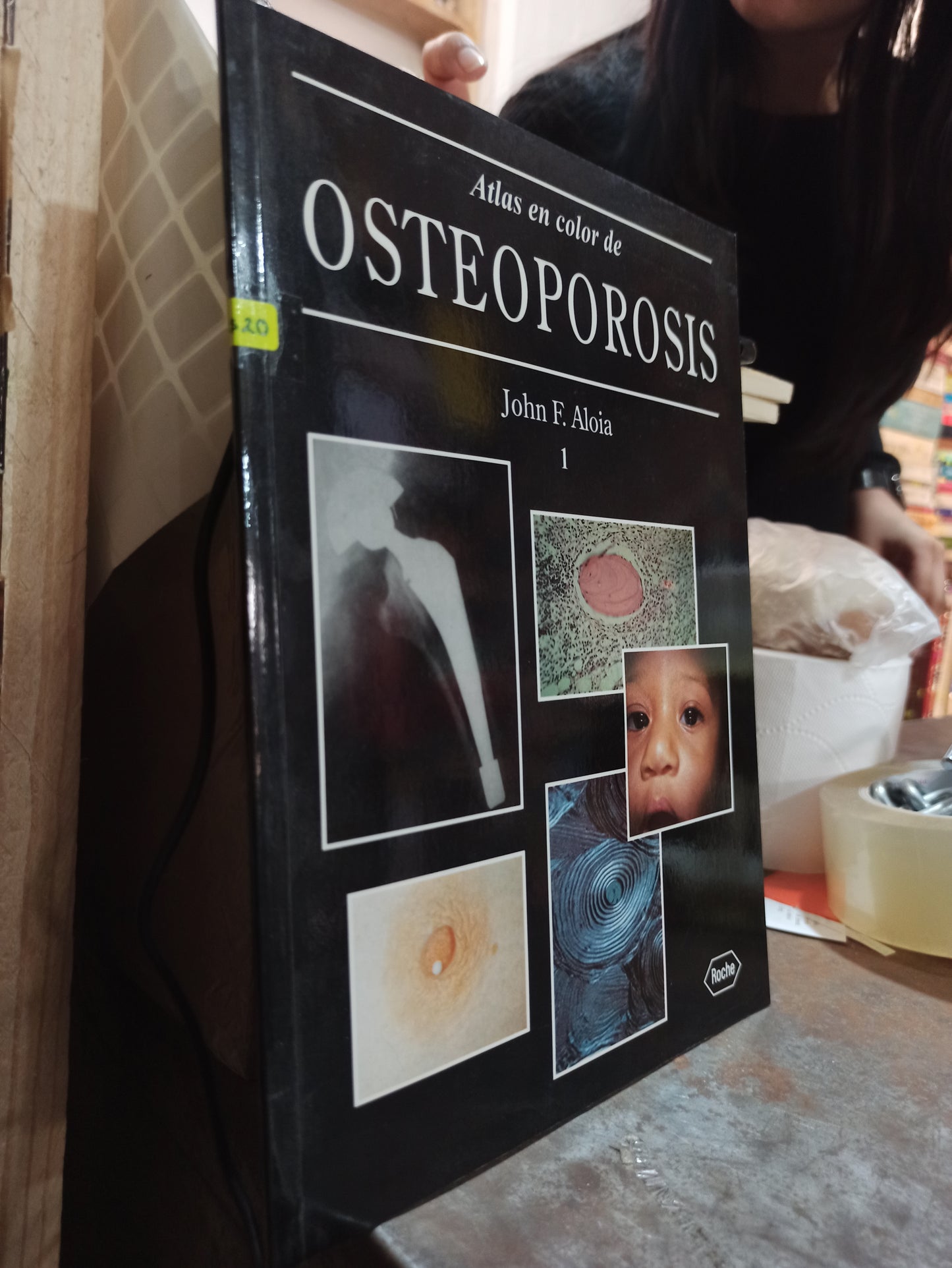 ATLAS EN COLOR DE OSTEOPOROSIS POR JOHN F. ALOIA USADO SALUD ALDAMA