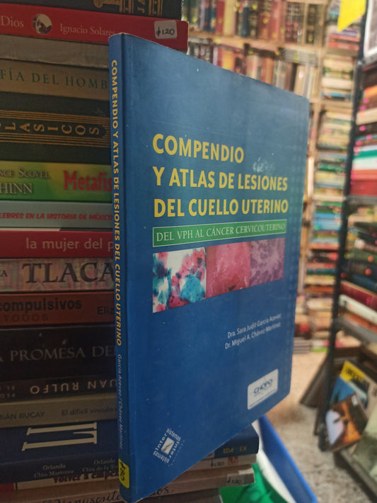 COMPENDIO Y ATLAS DE LESIONES DEL CULLERO UTERINO POR SARA JUDIT GARCIA ACEVEZ USADO SALUD ALDAMA